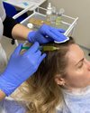 Обучение техникам мезотерапии. Один из этапов - мезотерапия волосистой части головы.